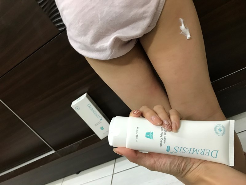 女人知己試用大隊,口碑行銷,部落客行銷,Dermesis迪敏施 Plus 涵鈣休異膚乳霜 滋潤型 120ml,Dermesis迪敏施,滋潤,保溼,舒緩,針對敏感性肌膚皮膚修護屏障,保溼性佳,更加滋潤,減緩水分散失,修護乾燥,有效預防皮膚乾裂,減少肌膚脫屑/脫皮,保濕舒緩,長效滋潤,俢護健康肌