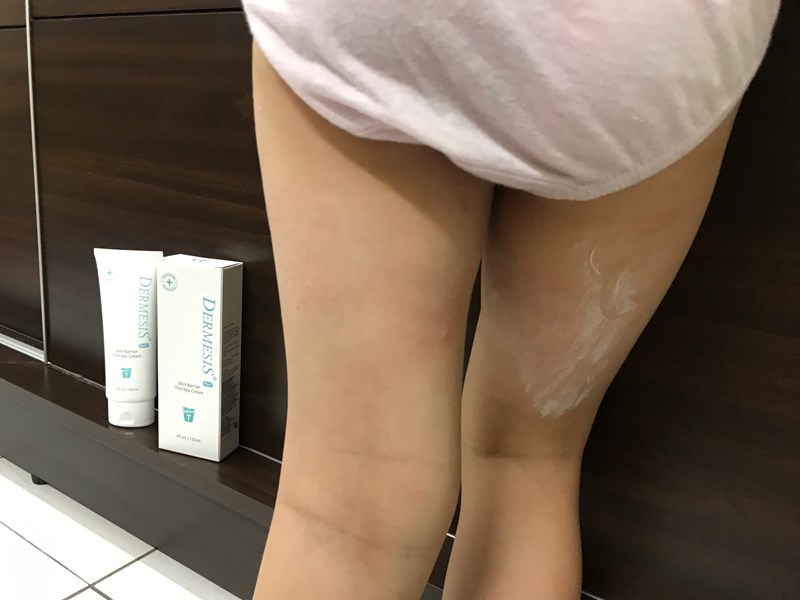 女人知己試用大隊,口碑行銷,部落客行銷,Dermesis迪敏施 Plus 涵鈣休異膚乳霜 滋潤型 120ml,Dermesis迪敏施,滋潤,保溼,舒緩,針對敏感性肌膚皮膚修護屏障,保溼性佳,更加滋潤,減緩水分散失,修護乾燥,有效預防皮膚乾裂,減少肌膚脫屑/脫皮,保濕舒緩,長效滋潤,俢護健康肌