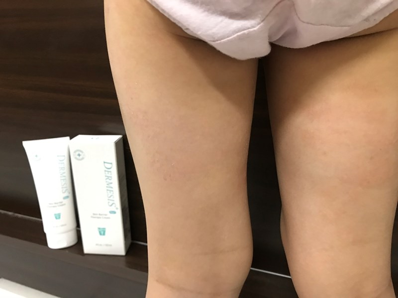 女人知己試用大隊,口碑行銷,部落客行銷,Dermesis迪敏施 Plus 涵鈣休異膚乳霜 滋潤型 120ml,Dermesis迪敏施,滋潤,保溼,舒緩,針對敏感性肌膚皮膚修護屏障,保溼性佳,更加滋潤,減緩水分散失,修護乾燥,有效預防皮膚乾裂,減少肌膚脫屑/脫皮,保濕舒緩,長效滋潤,俢護健康肌