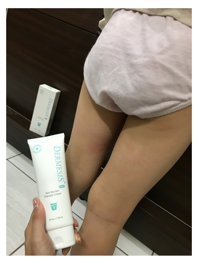 女人知己試用大隊,口碑行銷,部落客行銷,Dermesis迪敏施 Plus 涵鈣休異膚乳霜 滋潤型 120ml,Dermesis迪敏施,滋潤,保溼,舒緩,針對敏感性肌膚皮膚修護屏障,保溼性佳,更加滋潤,減緩水分散失,修護乾燥,有效預防皮膚乾裂,減少肌膚脫屑/脫皮,保濕舒緩,長效滋潤,俢護健康肌