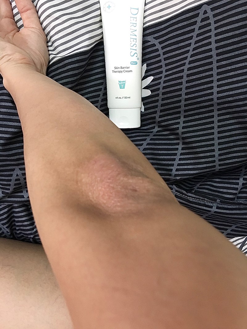 女人知己試用大隊,口碑行銷,部落客行銷,Dermesis迪敏施 Plus 涵鈣休異膚乳霜 滋潤型 120ml,Dermesis迪敏施,滋潤,保溼,舒緩,針對敏感性肌膚皮膚修護屏障,保溼性佳,更加滋潤,減緩水分散失,修護乾燥,有效預防皮膚乾裂,減少肌膚脫屑/脫皮,保濕舒緩,長效滋潤,俢護健康肌