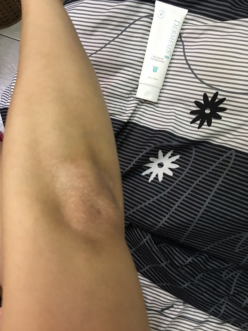 女人知己試用大隊,口碑行銷,部落客行銷,Dermesis迪敏施 Plus 涵鈣休異膚乳霜 滋潤型 120ml,Dermesis迪敏施,滋潤,保溼,舒緩,針對敏感性肌膚皮膚修護屏障,保溼性佳,更加滋潤,減緩水分散失,修護乾燥,有效預防皮膚乾裂,減少肌膚脫屑/脫皮,保濕舒緩,長效滋潤,俢護健康肌