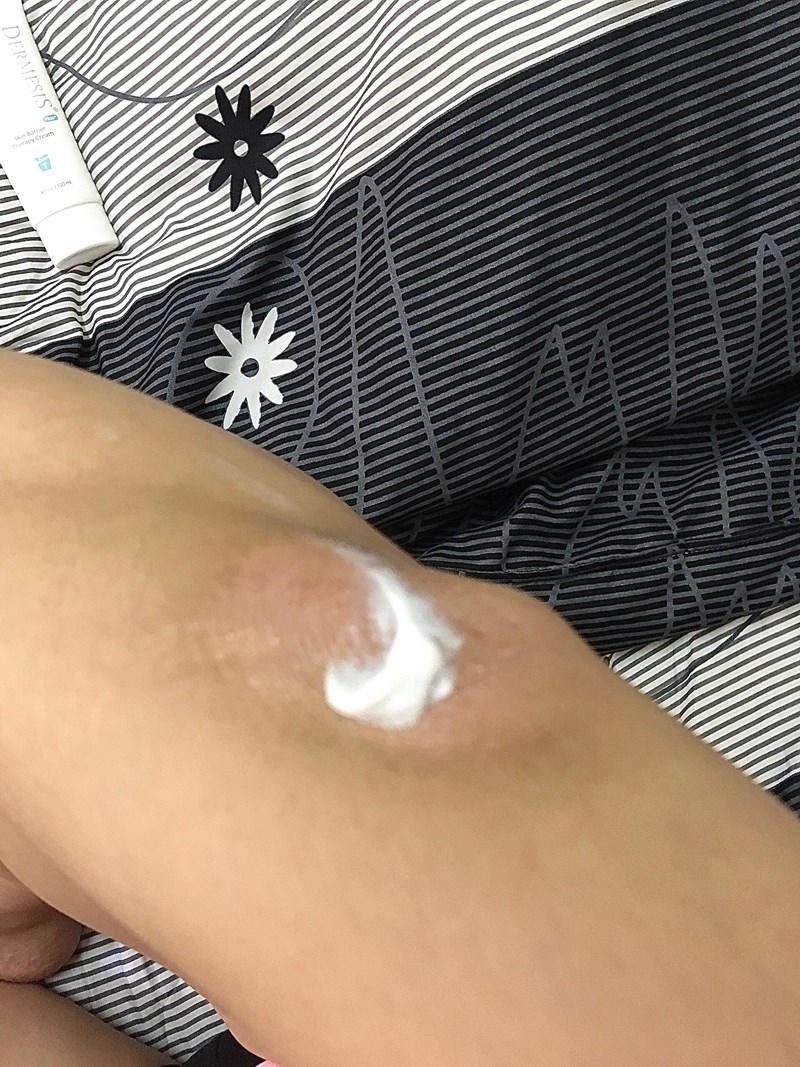 女人知己試用大隊,口碑行銷,部落客行銷,Dermesis迪敏施 Plus 涵鈣休異膚乳霜 滋潤型 120ml,Dermesis迪敏施,滋潤,保溼,舒緩,針對敏感性肌膚皮膚修護屏障,保溼性佳,更加滋潤,減緩水分散失,修護乾燥,有效預防皮膚乾裂,減少肌膚脫屑/脫皮,保濕舒緩,長效滋潤,俢護健康肌