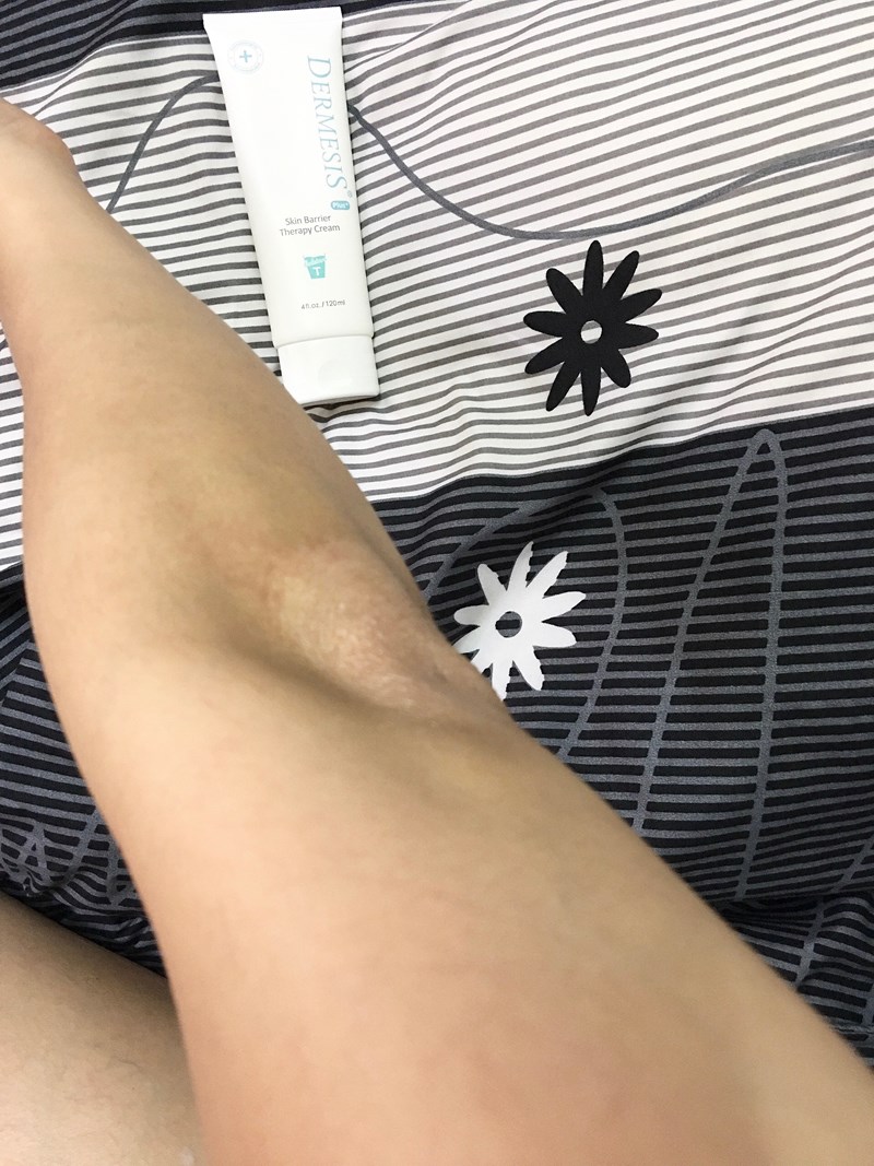 女人知己試用大隊,口碑行銷,部落客行銷,Dermesis迪敏施 Plus 涵鈣休異膚乳霜 滋潤型 120ml,Dermesis迪敏施,滋潤,保溼,舒緩,針對敏感性肌膚皮膚修護屏障,保溼性佳,更加滋潤,減緩水分散失,修護乾燥,有效預防皮膚乾裂,減少肌膚脫屑/脫皮,保濕舒緩,長效滋潤,俢護健康肌