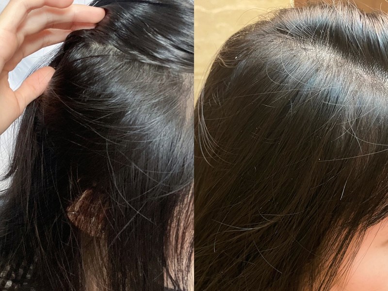 女人知己試用大隊,口碑行銷,部落客行銷,雅諾士植萃賦活禮盒組,植萃賦活禮盒組,植萃賦活淨化潔淨露,植萃賦活滋養護髮素,植萃賦活滋養頭皮安瓶,頭皮養護,居家頭皮保養,強健髮根,滋養頭皮,改善毛燥髮質,毛髮豐盈,調理頭皮,滋養毛髮,洗髮精推薦,髮品推薦