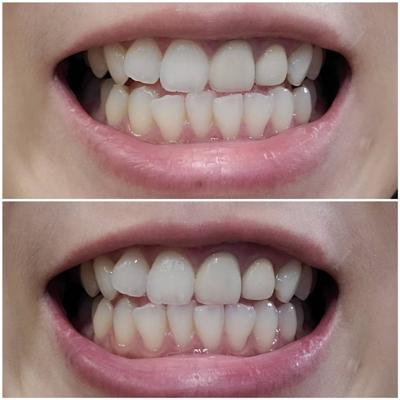 女人知己試用大隊,口碑行銷,部落客行銷,Zeola蕾歐樂閃亮全效牙膏,ZEOLA,蕾歐樂,安全亮白,12種有效成分,日本Zettoc專業口腔大廠製造,65年研發經驗,專業無瑕亮白配方