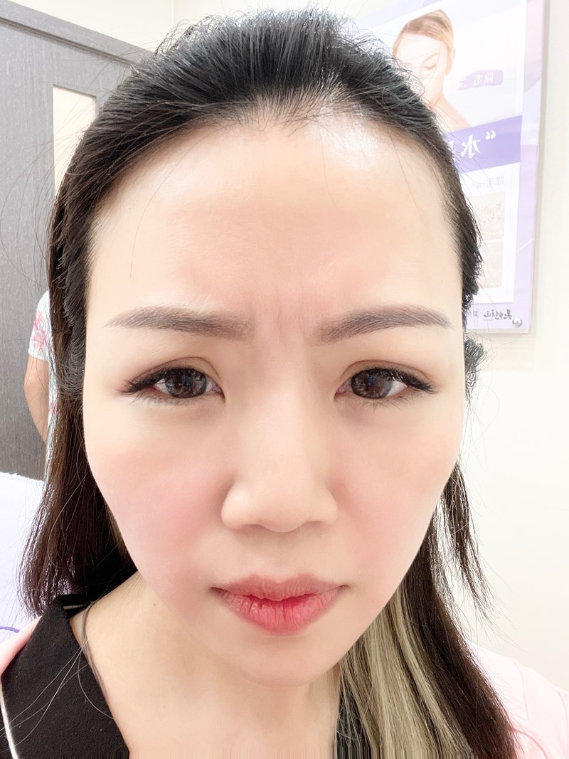 女人知己試用大隊,口碑行銷,部落客行銷,美怡雅時尚美學,彰化醫美,美怡雅時尚美學,每一秒都是你的高光時刻,美麗其實很簡單,賴政光醫師,高壓氧氣艙,醫學美容,雷射光療,抗老醫學,微整形,肉毒,玻尿酸,音波,腋下除毛,聚左旋乳酸,舒顏萃