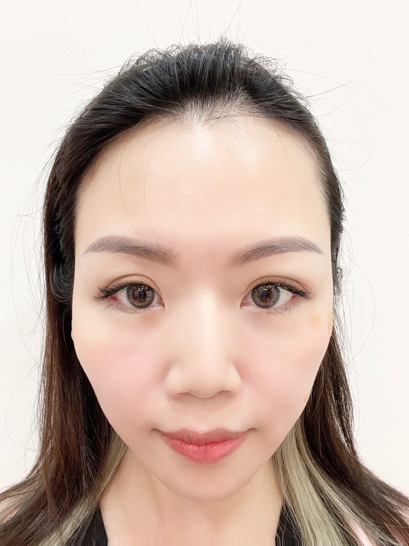 女人知己試用大隊,口碑行銷,部落客行銷,美怡雅時尚美學,彰化醫美,美怡雅時尚美學,每一秒都是你的高光時刻,美麗其實很簡單,賴政光醫師,高壓氧氣艙,醫學美容,雷射光療,抗老醫學,微整形,肉毒,玻尿酸,音波,腋下除毛,聚左旋乳酸,舒顏萃