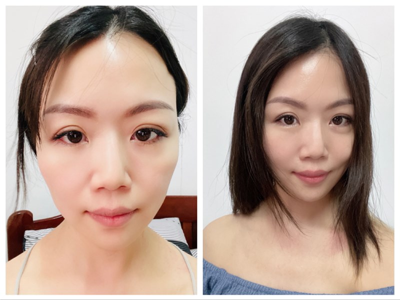 女人知己試用大隊,口碑行銷,部落客行銷,美怡雅時尚美學,彰化醫美,美怡雅時尚美學,每一秒都是你的高光時刻,美麗其實很簡單,賴政光醫師,高壓氧氣艙,醫學美容,雷射光療,抗老醫學,微整形,肉毒,玻尿酸,音波,腋下除毛,聚左旋乳酸,舒顏萃