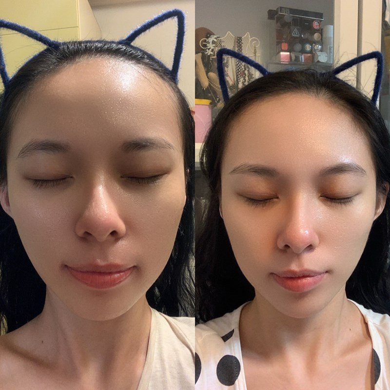 女人知己試用大隊,口碑行銷,部落客行銷,美怡雅時尚美學,彰化醫美,美怡雅時尚美學,每一秒都是你的高光時刻,美麗其實很簡單,賴政光醫師,高壓氧氣艙,醫學美容,雷射光療,抗老醫學,微整形,肉毒,玻尿酸,音波,腋下除毛,聚左旋乳酸,舒顏萃