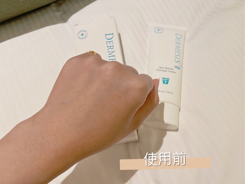 女人知己試用大隊,口碑行銷,部落客行銷,Dermesis迪敏施 Plus 涵鈣休異膚乳霜 滋潤型 120ml,Dermesis迪敏施,滋潤,保溼,舒緩,針對敏感性肌膚皮膚修護屏障,保溼性佳,更加滋潤,減緩水分散失,修護乾燥,有效預防皮膚乾裂,減少肌膚脫屑/脫皮,保濕舒緩,長效滋潤,俢護健康肌