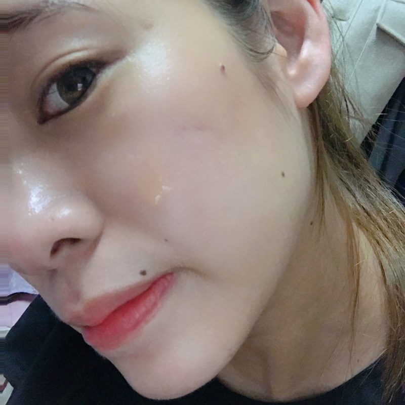 女人知己試用大隊,口碑行銷,部落客行銷,AYJUN 精華抗痘組,AYJUN 全方位修護精華,AYJUN 白夏菊呵護保濕精華,杏仁酸,七葉樹,金縷梅,茶樹精油,舒緩,保濕,平衡油脂分泌,淨化毛孔,抗痘,保水,改善肌膚暗沉,去除老廢角質,調理膚質,白夏菊,天然海藻醣,洋甘菊,舒敏,保濕,保水,舒緩,鎖水,滋潤肌膚,敏感性肌膚