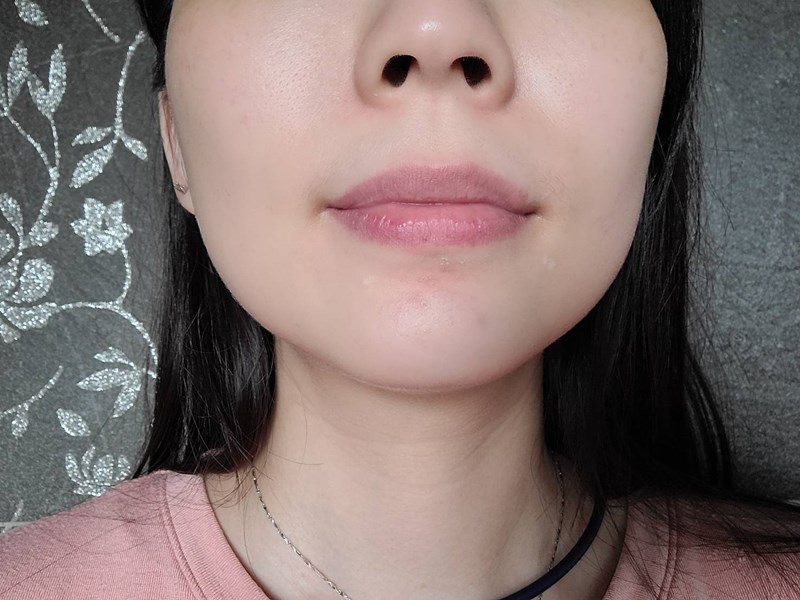 女人知己試用大隊,口碑行銷,部落客行銷,AYJUN 精華抗痘組,AYJUN 全方位修護精華,AYJUN 白夏菊呵護保濕精華,杏仁酸,七葉樹,金縷梅,茶樹精油,舒緩,保濕,平衡油脂分泌,淨化毛孔,抗痘,保水,改善肌膚暗沉,去除老廢角質,調理膚質,白夏菊,天然海藻醣,洋甘菊,舒敏,保濕,保水,舒緩,鎖水,滋潤肌膚,敏感性肌膚