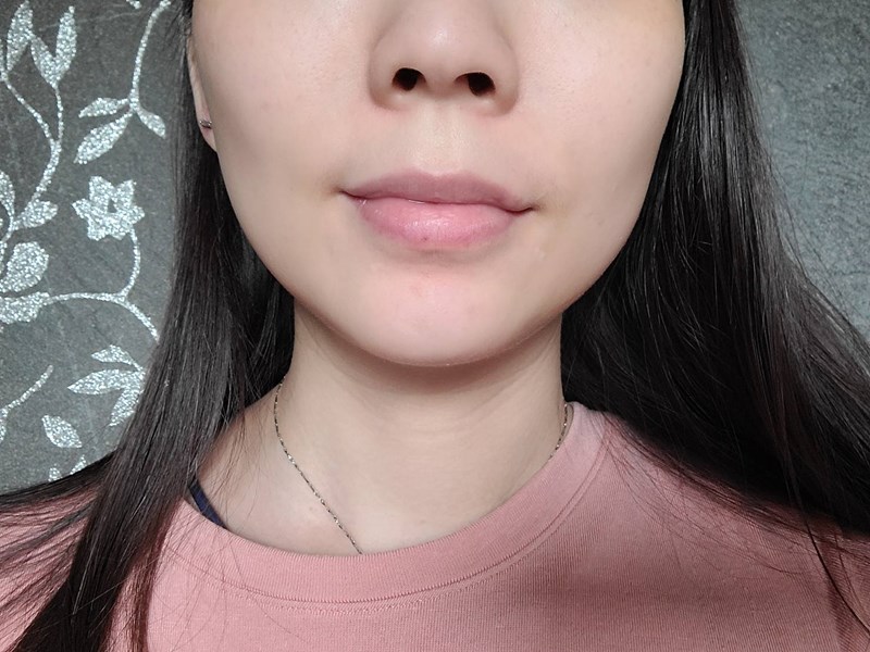 女人知己試用大隊,口碑行銷,部落客行銷,AYJUN 精華抗痘組,AYJUN 全方位修護精華,AYJUN 白夏菊呵護保濕精華,杏仁酸,七葉樹,金縷梅,茶樹精油,舒緩,保濕,平衡油脂分泌,淨化毛孔,抗痘,保水,改善肌膚暗沉,去除老廢角質,調理膚質,白夏菊,天然海藻醣,洋甘菊,舒敏,保濕,保水,舒緩,鎖水,滋潤肌膚,敏感性肌膚