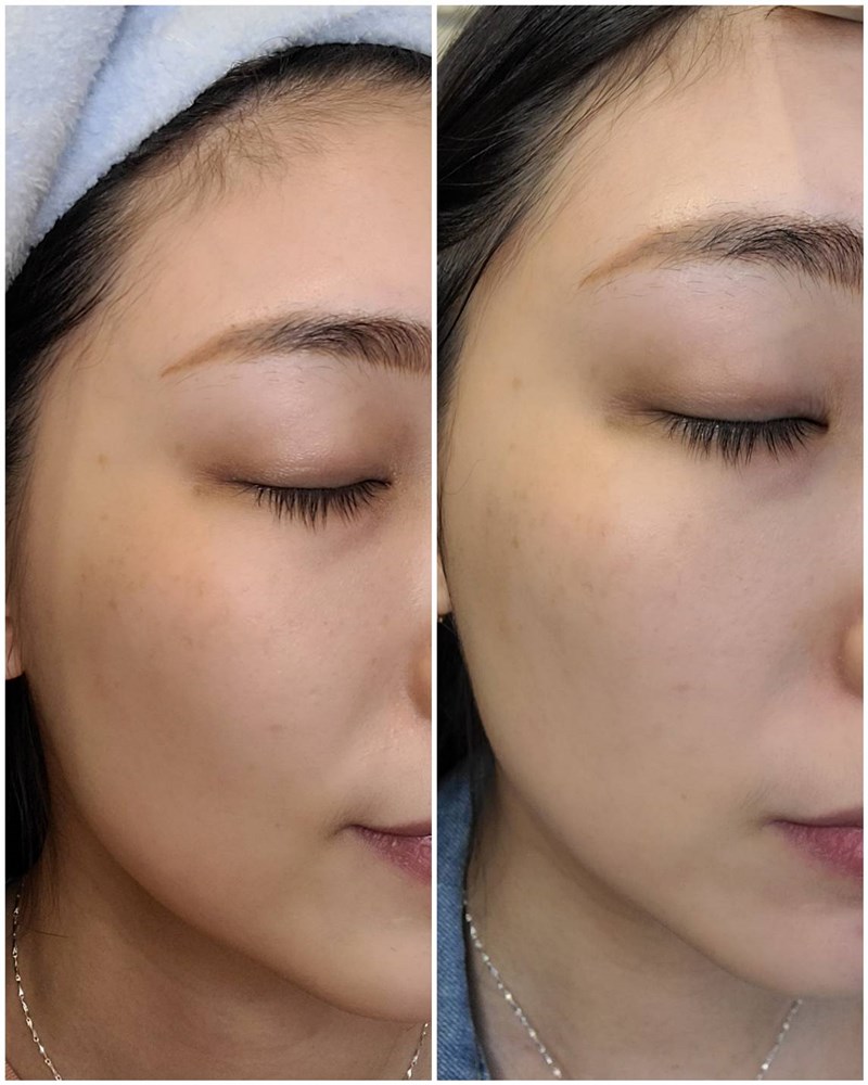 女人知己試用大隊,口碑行銷,部落客行銷,Dermacare28鎖水磁石高效保濕安瓶(天使瓶),天使瓶,MIT品牌,高級成分,輕便性,獨立包裝保鮮,衛生,醫美雷射術後必備,鎖水不黏膩