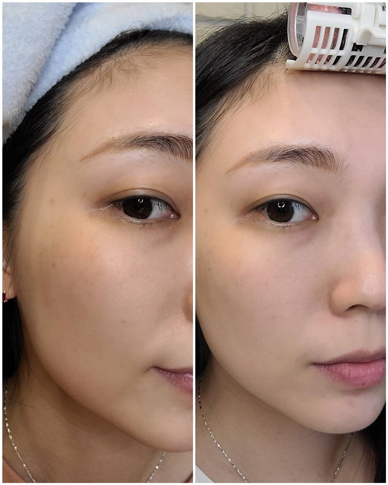 女人知己試用大隊,口碑行銷,部落客行銷,Dermacare28鎖水磁石高效保濕安瓶(天使瓶),天使瓶,MIT品牌,高級成分,輕便性,獨立包裝保鮮,衛生,醫美雷射術後必備,鎖水不黏膩