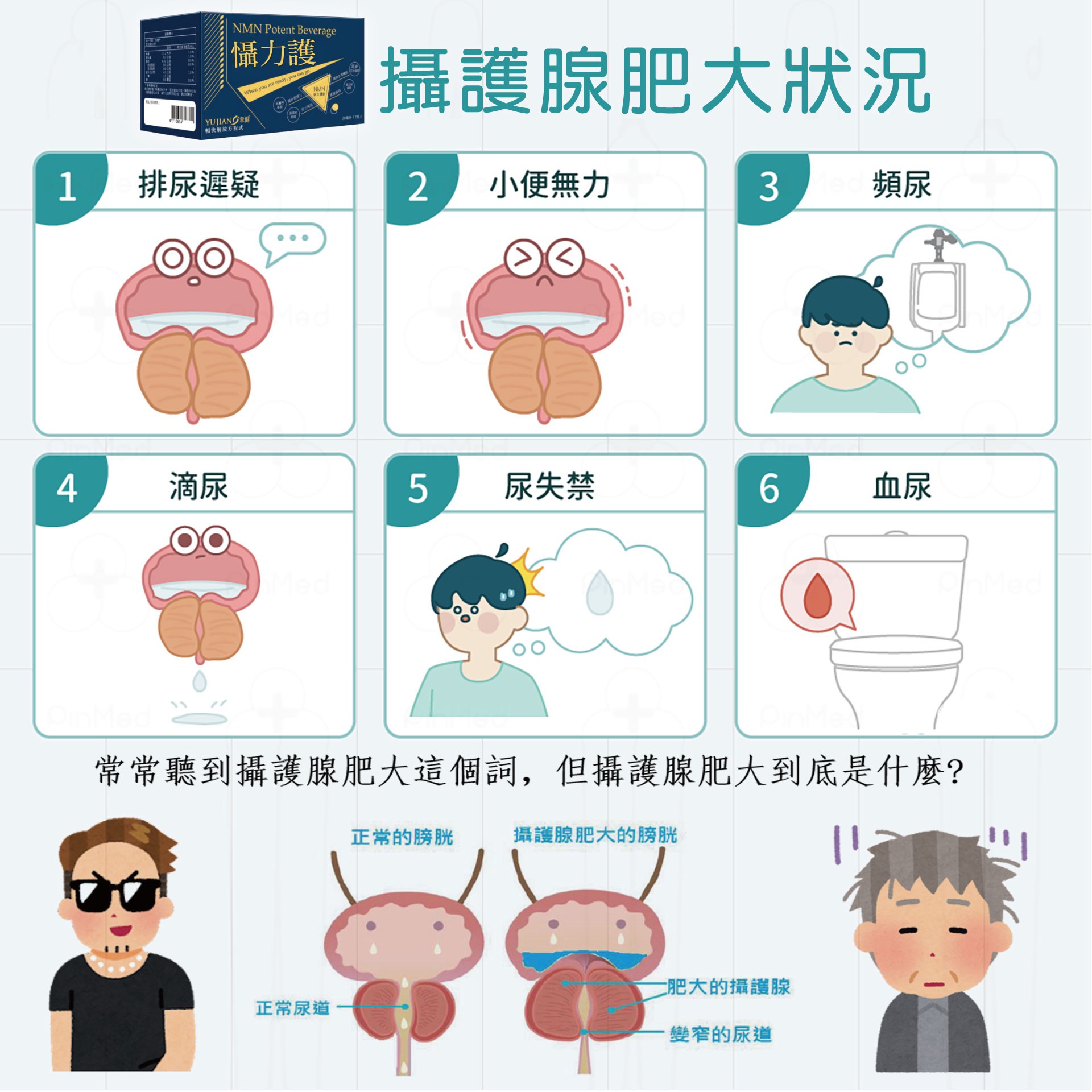 試用