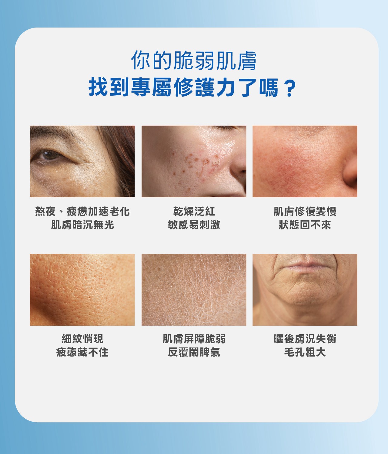試用