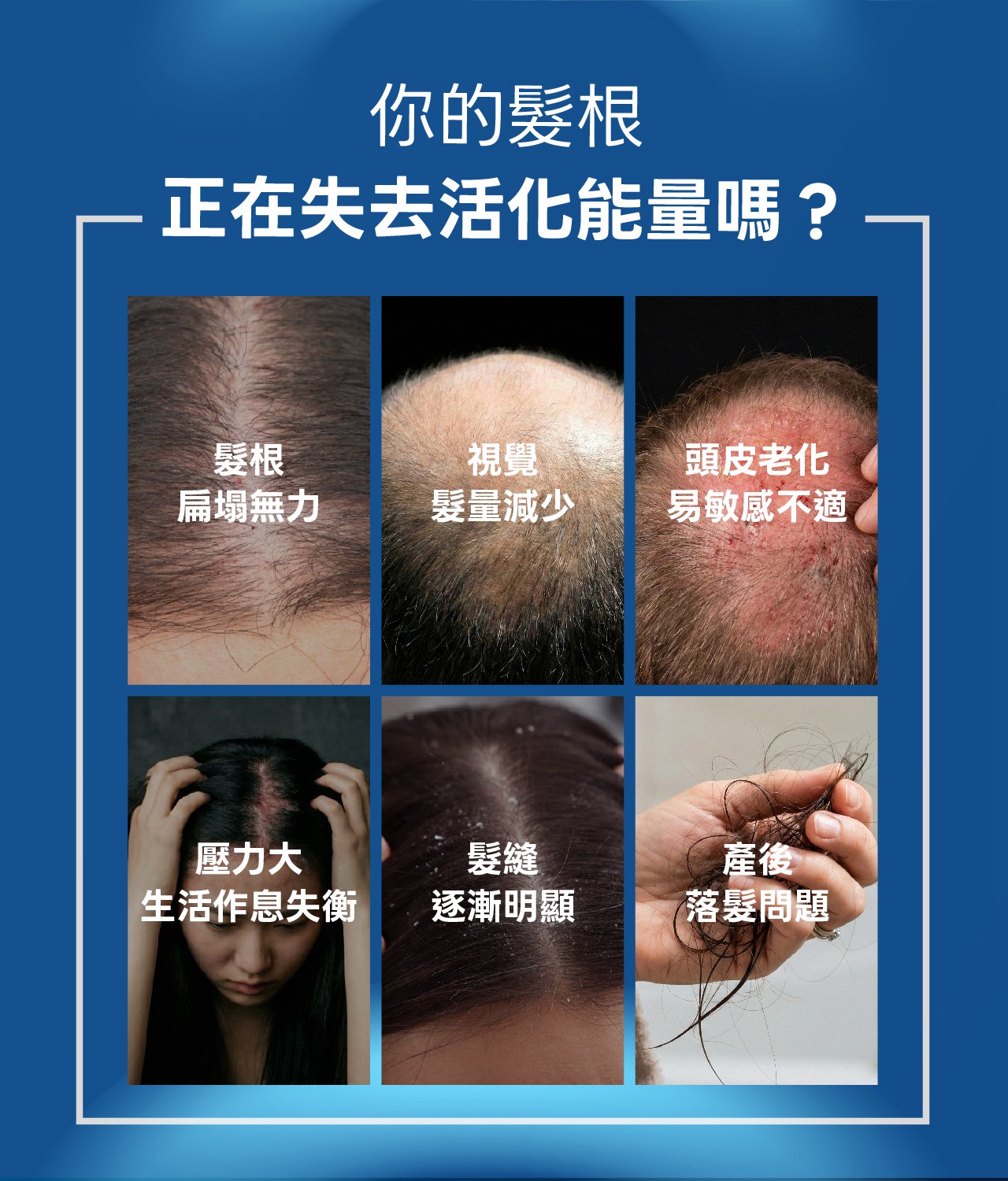 試用
