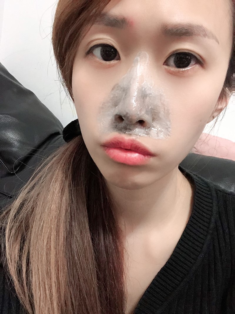 女人知己試用大隊,JUSO KURO PACK 2分鐘去黑頭粉刺泡泡奇蹟鼻膜,碳酸泡泡鼻膜,黑炭凝膠,清除毛孔汙垢,毛孔清潔