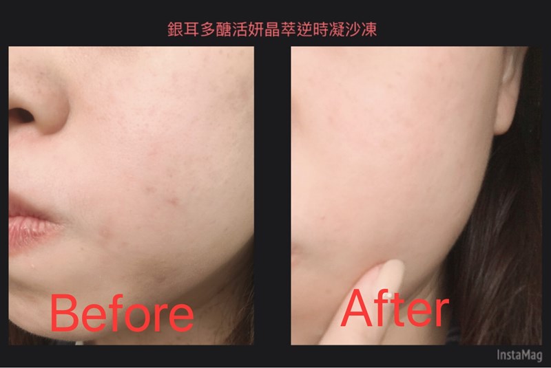 女人知己試用大隊,銀耳多醣活妍晶萃逆時凝沙凍,銀耳萃取,
植萃精華,吉拉索蘆薈萃取,祕魯人蔘根,橄欖葉萃取,
露珠草萃取液,無人工香料,不含酒精,
清爽不黏膩,保濕,柔嫩,光滑,緊實,改善暗沉
