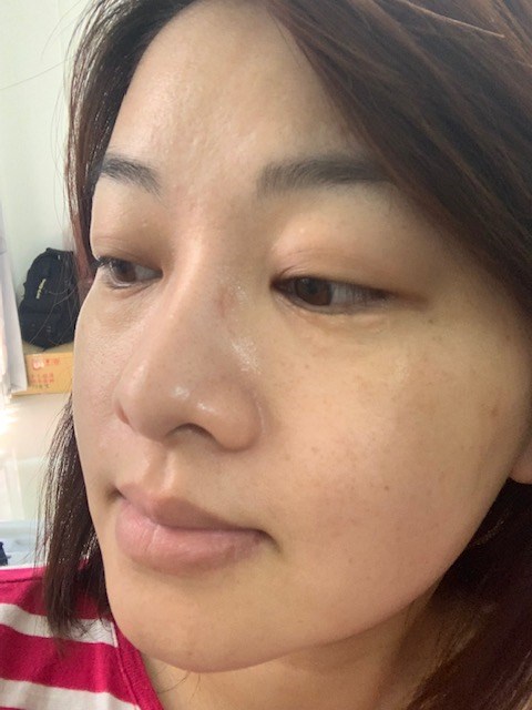 VICHY薇姿15%維他命C超導安瓶,安瓶推薦,維他命C,加強提亮