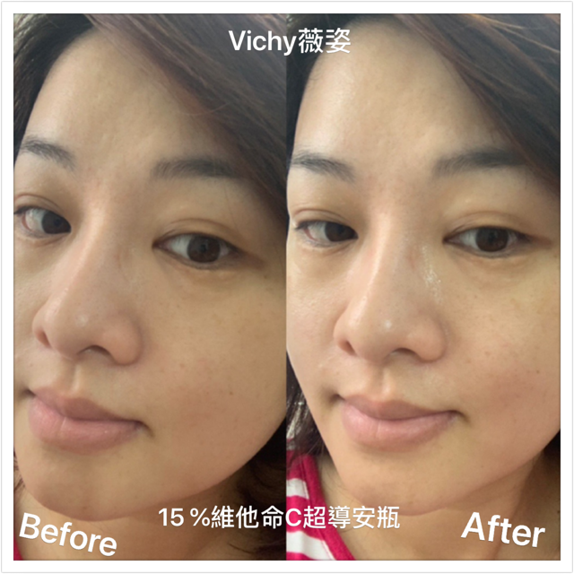 VICHY薇姿15%維他命C超導安瓶,安瓶推薦,維他命C,加強提亮