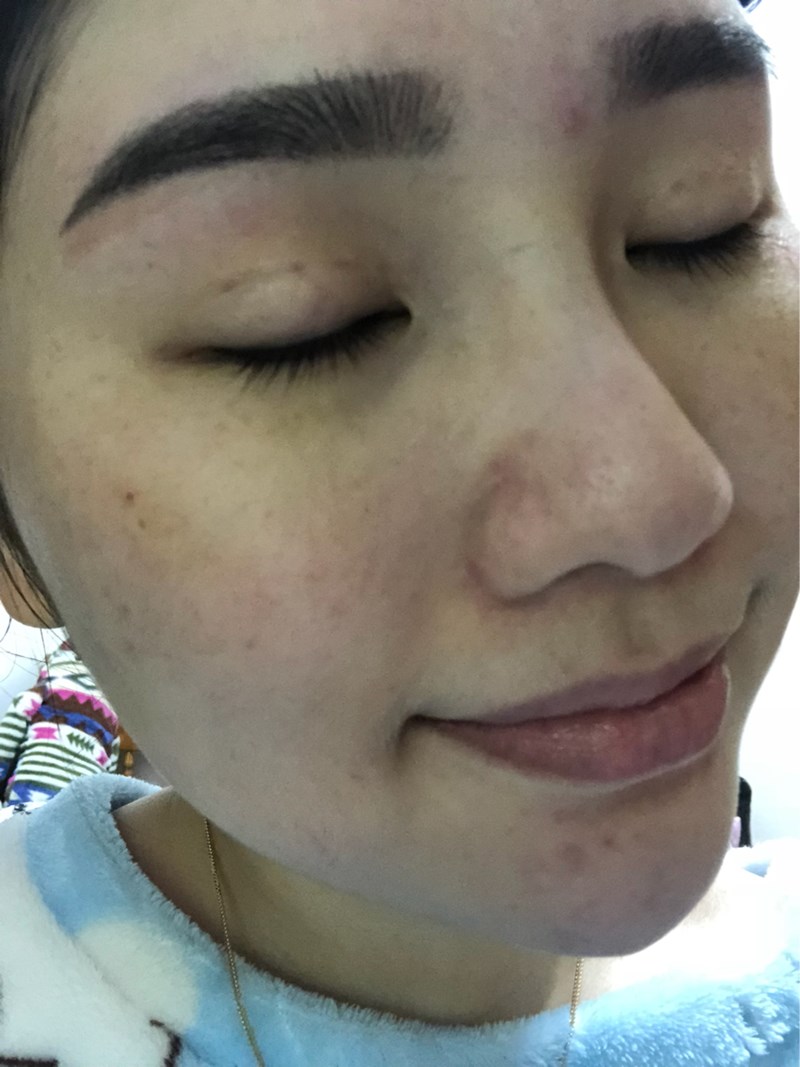 VICHY薇姿15%維他命C超導安瓶,安瓶推薦,維他命C,加強提亮