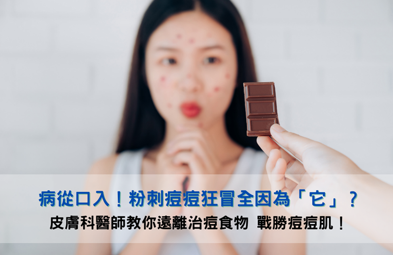 病從口入!粉刺痘痘狂冒全因為「它」?皮膚科醫師教你遠離治痘食物 戰勝痘痘肌!
